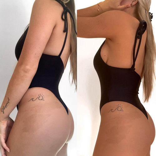 Caramelle gommose abbronzanti
